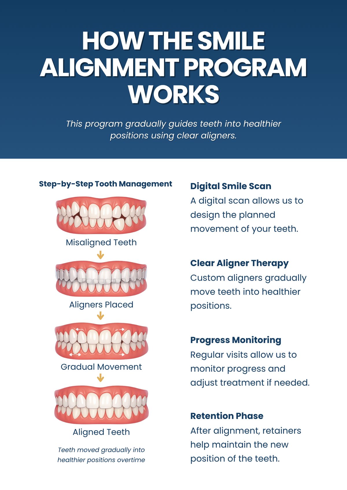 Step-by-step alignment process: misaligned, aligners placed, gradual movement, aligned
